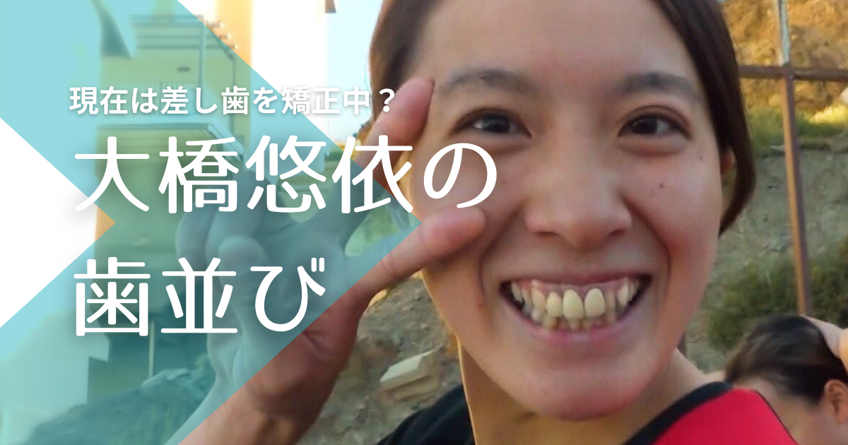 【画像比較】大橋悠依の歯並びが黄色いのは差し歯！歯列矯正で綺麗になったと話題！